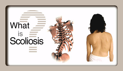 woman-scoliosis