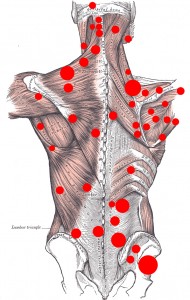 Freehold relieve muscle pain