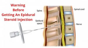Epidural steroid injections are dangerous