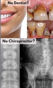 If you neglect your teeth they decay, if you neglect your spine it also decays but which one can be replaced?