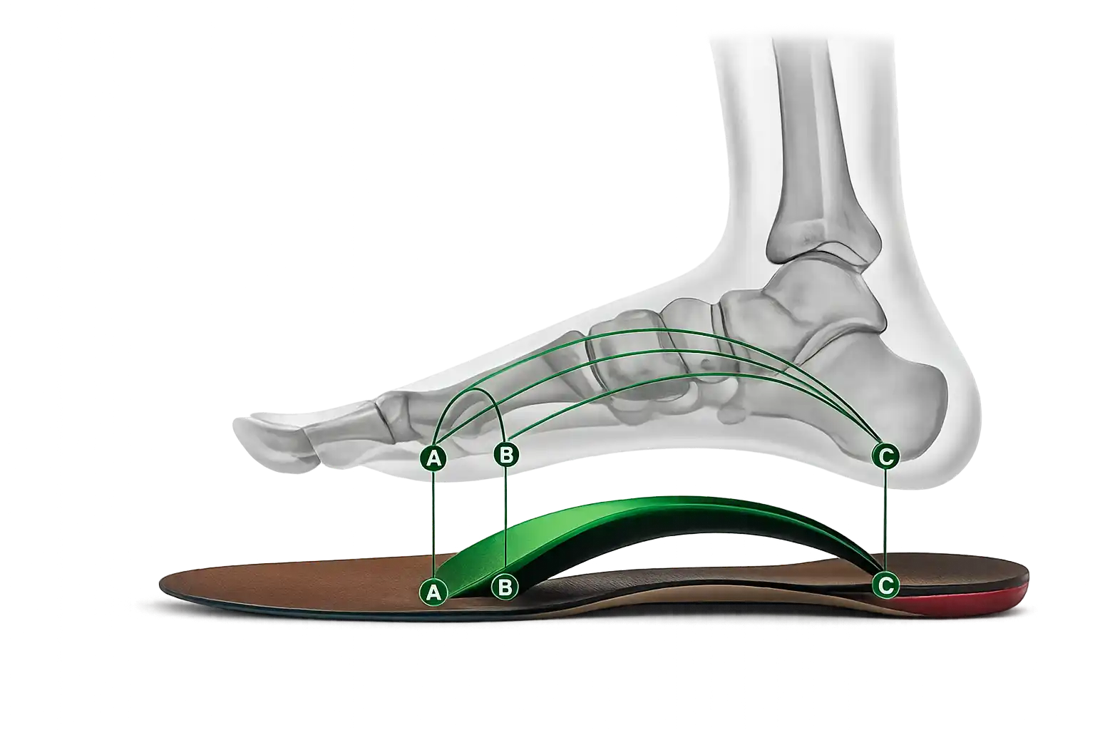 Foot over custom orthotics showcasing the precision points
