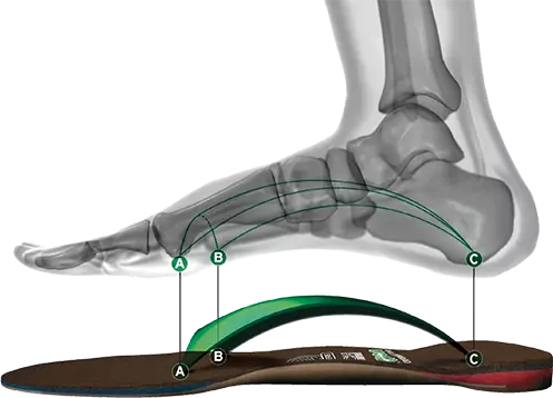 Foot Orthotics and Chiropractic Help with 5 red flags that can lead to back pain